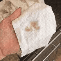 Miracle Stain Remover Spray - Toxic Bottled Spray All