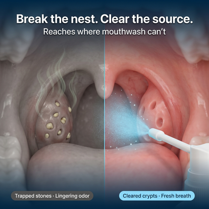 Tonsil Stone Cleaner - Deep Clean & Protective Barrier