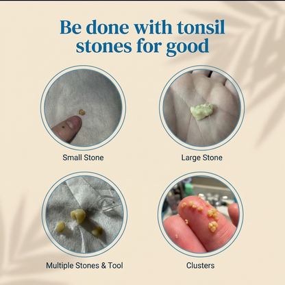 Tonsil Stone Cleaner - Deep Clean & Protective Barrier